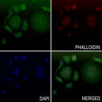 3 - Anti-ADAMTS10 Antibody AP60213