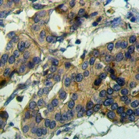 19 - Anti-ADAMTS10 Antibody AP60213