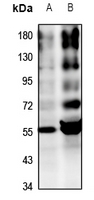 1 - Anti-Alpha-2A Adrenergic Receptor Antibody AP60214