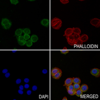 3 - Anti-ALDH1A1 Antibody AP60215