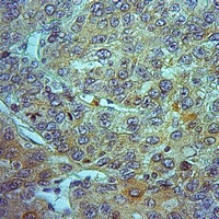 19 - Anti-ALDH1A1 Antibody AP60215
