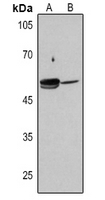 1 - Anti-ALDH1A1 Antibody AP60215