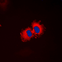 3 - Anti-ALDH1A2 Antibody AP60216