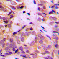 19 - Anti-ALDH1A2 Antibody AP60216