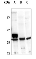 1 - Anti-ALDH1A2 Antibody AP60216