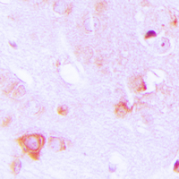 19 - Anti-ALDOC Antibody AP60217