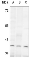 1 - Anti-ALDOC Antibody AP60217