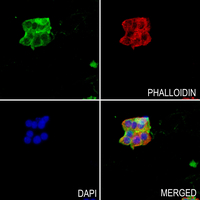 3 - Anti-Amphiphysin 1 Antibody AP60218