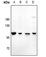 1 - Anti-Amphiphysin 1 Antibody AP60218