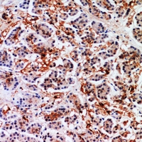 19 - Anti-Annexin A7 Antibody AP60219