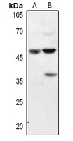 1 - Anti-Annexin A7 Antibody AP60219