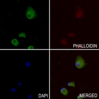 3 - Anti-Apolipoprotein L1 Antibody AP60221