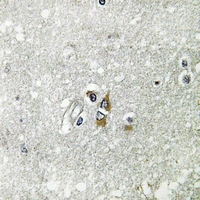 19 - Anti-Apolipoprotein L1 Antibody AP60221