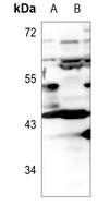 1 - Anti-Apolipoprotein L1 Antibody AP60221
