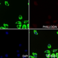 3 - Anti-Apolipoprotein L3 Antibody AP60222