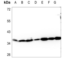 1 - Anti-Apolipoprotein L3 Antibody AP60222