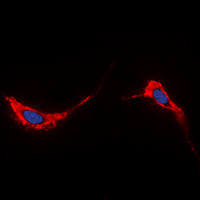 3 - Anti-Aquaporin 2 Antibody AP60223