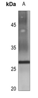 1 - Anti-Aquaporin 2 Antibody AP60223