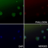 3 - Anti-Arylsulfatase B Antibody AP60224