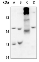 1 - Anti-Arylsulfatase B Antibody AP60224