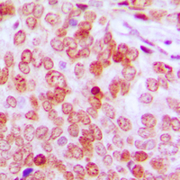 19 - Anti-ATF5 Antibody AP60225