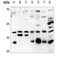1 - Anti-ATF5 Antibody AP60225