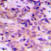 19 - Anti-ATG4B Antibody AP60226