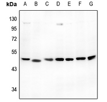 1 - Anti-ATG4B Antibody AP60226