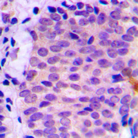 19 - Anti-ATG4C Antibody AP60227