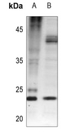 1 - Anti-BAD (Phospho-S112) Antibody AP60228