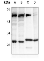 1 - Anti-BAP31 Antibody AP60230