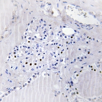 19 - Anti-BinCARD Antibody AP60233