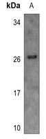 1 - Anti-BinCARD Antibody AP60233