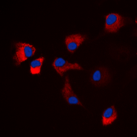 3 - Anti-CaMK2 alpha/delta (Phospho-T286) Antibody AP60234