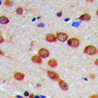 19 - Anti-CaMK2 alpha/delta (Phospho-T286) Antibody AP60234