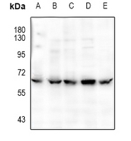 1 - Anti-CaMK2 alpha/delta (Phospho-T286) Antibody AP60234