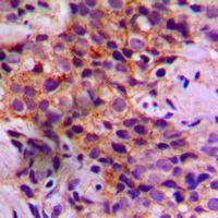 19 - Anti-Caspase 2 Antibody AP60235