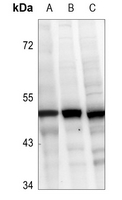 1 - Anti-Caspase 2 Antibody AP60235