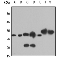 1 - Anti-Caspase 6 Antibody AP60236