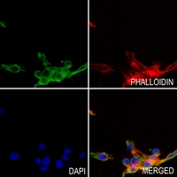 3 - Anti-CCL7 Antibody AP60237