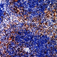 19 - Anti-CCR4 Antibody AP60238