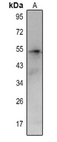 1 - Anti-CCR4 Antibody AP60238