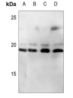 1 - Anti-CD247 Antibody AP60239