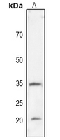 1 - Anti-CD274 Antibody AP60240