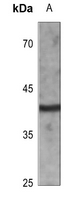 1 - Anti-CD72 Antibody AP60241