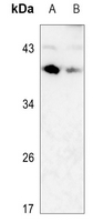1 - Anti-CD79b Antibody AP60242