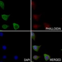 3 - Anti-CDCA2 Antibody AP60243