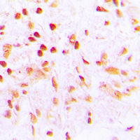19 - Anti-CDCA2 Antibody AP60243