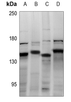 1 - Anti-CDCA2 Antibody AP60243