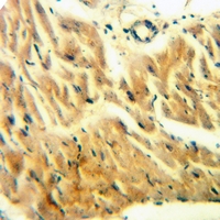 19 - Anti-CDK2AP1 Antibody AP60245